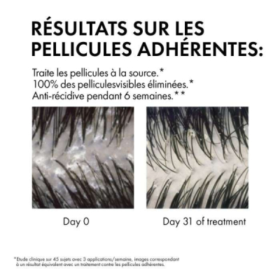 DERCOS - Vichy dercos shampoing anti pelliculaire ds cheveux secs 200 ml